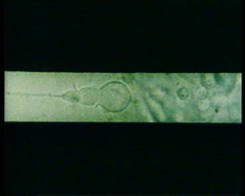 "Mikrokinematographische Zeitdehnungsaufnahmen der Entladung der Nematocysten bei Hydra attenuata zeigen, daß diese spezialisierte Exocytose in weniger als 3 Millisekunden abgeschlossen ist." Forschungsfilm aus dem Jahr 1988.