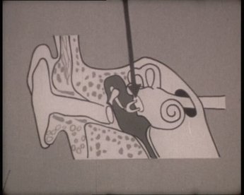 An einem menschlichen Schläfenbeinpräparat wird der Weg von Schallwellen durch die Gehörknochen im Mittelohr demonstriert (1963).